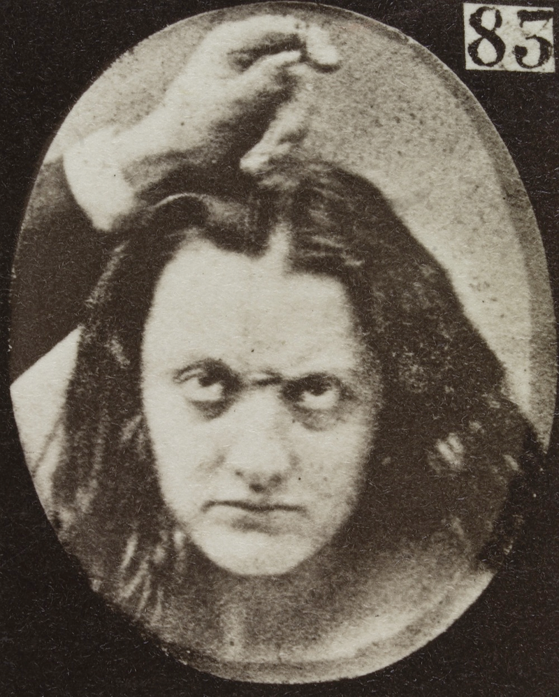 Illustration for article titled Terrifying, Century-Old Photographs from Neuroscience Experiments